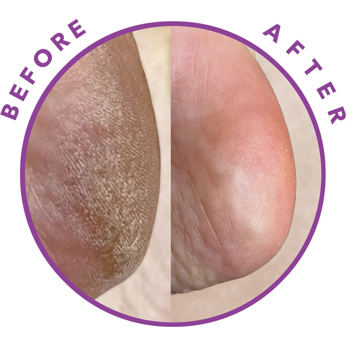 Barefoot Scientist Reboot Exfoliating Foot Peel - BRT01 image 5