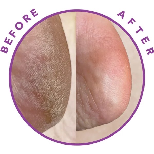 exfoliating foot peel foot peel mask foot peel for dry skin foot peel for calluses gentle foot peel Barefoot Scientist foot peel foot peel booties best foot peel for sensitive skin